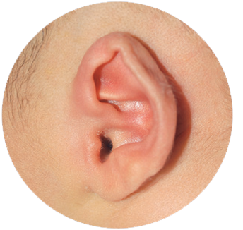 Před nasazením systému EarWell 